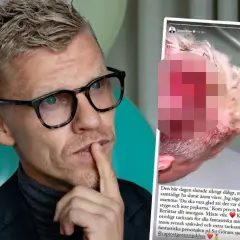 Bingo Rimer delar fotografier från akuten, tackar personalen på S:t Görans sjukhus.